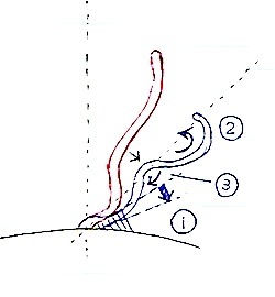 立ち耳の本格的な手術