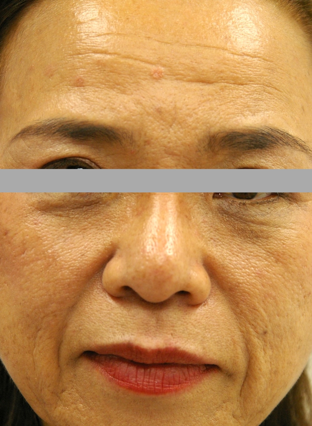 デトックス治療中　大江橋クリニック