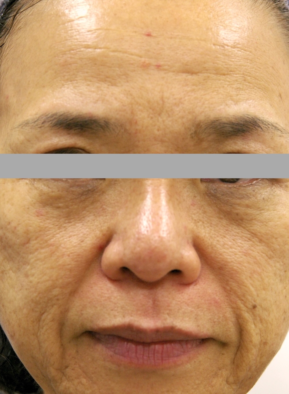 デトックス治療中　大江橋クリニック